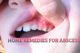 HOME REMEDIES FOR ABSCESS