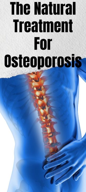 The Natural Treatment For Osteoporosis