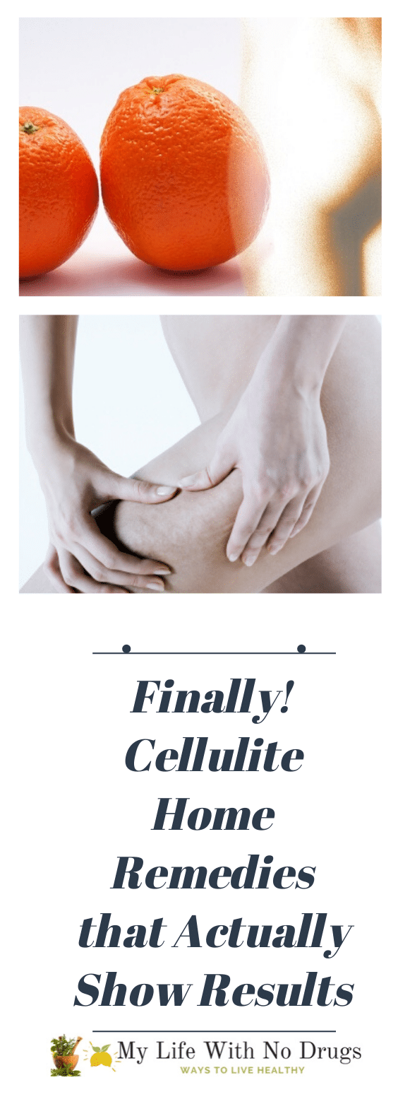 Finally! Cellulite Home Remedies that Actually Show Results