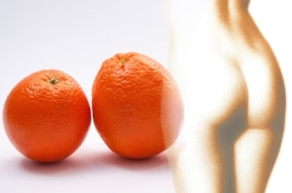 Orange Peel Cellulite