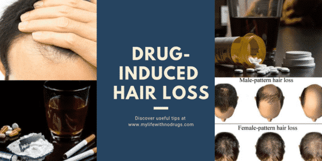 Drug-induced Hair Loss